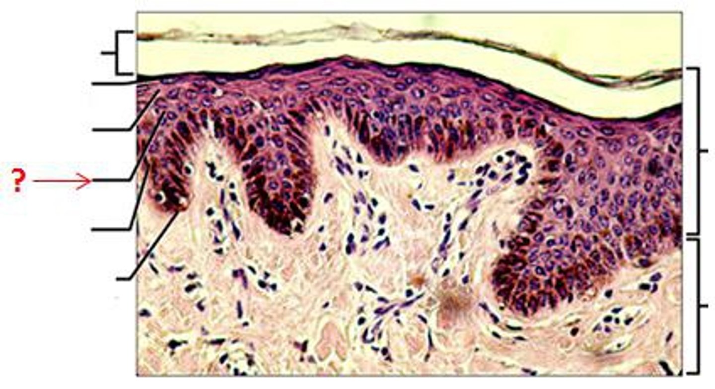 <p>is a layer of the epidermis found between the stratum granulosum and stratum basale. Held together by desmosomes</p>
