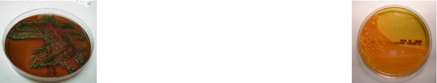 <p>This microorganism appears <strong>green</strong> on <strong>EMB plates</strong> and <strong>pink/orange</strong> on <strong>HE plates</strong> making it a <strong>lactose fermente</strong>r, which microorganism is it?</p>