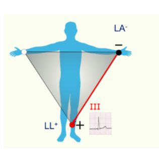 <ul><li><p>the leads record the electrical potential difference between 2 active electrodes</p></li><li><p>forms Einthoven triangle</p></li></ul><p></p><p></p>