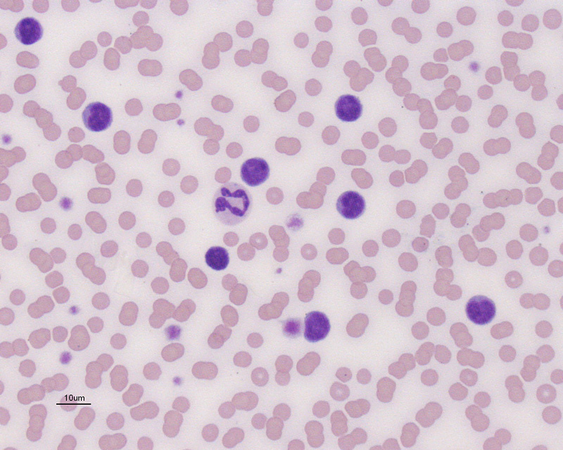 <p>Small Cell GI LSA Treatment</p>