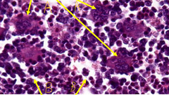 <p>What type of cells are indicated by the arrows labeled 'A' in this slide of canine claw?</p>