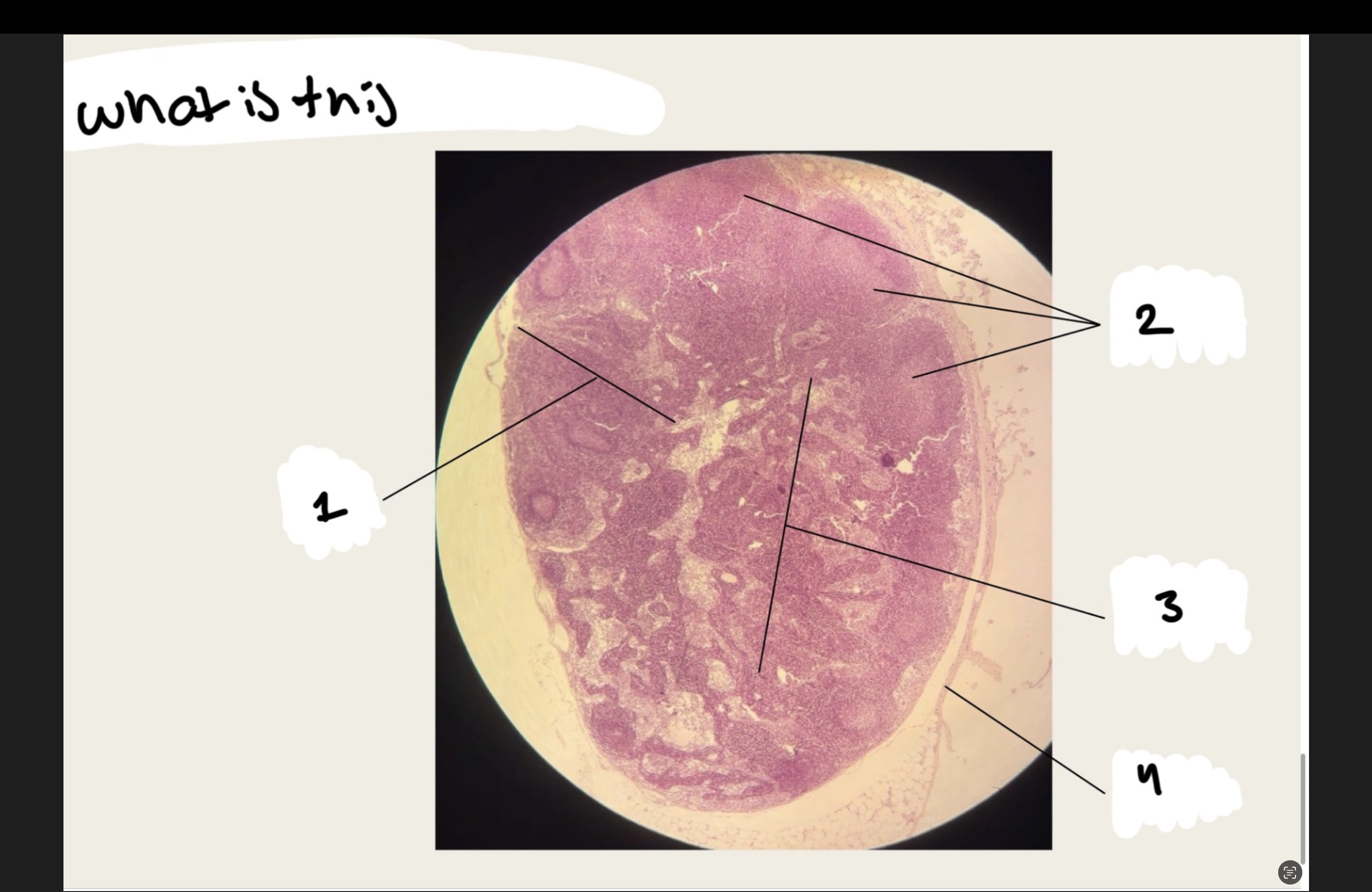 <p>what structure is this:</p><p>1.xx</p><p>2.xx</p><p>3.xx</p><p>4.xx</p>