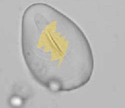 <p>Identify the hgihlighted feature </p>