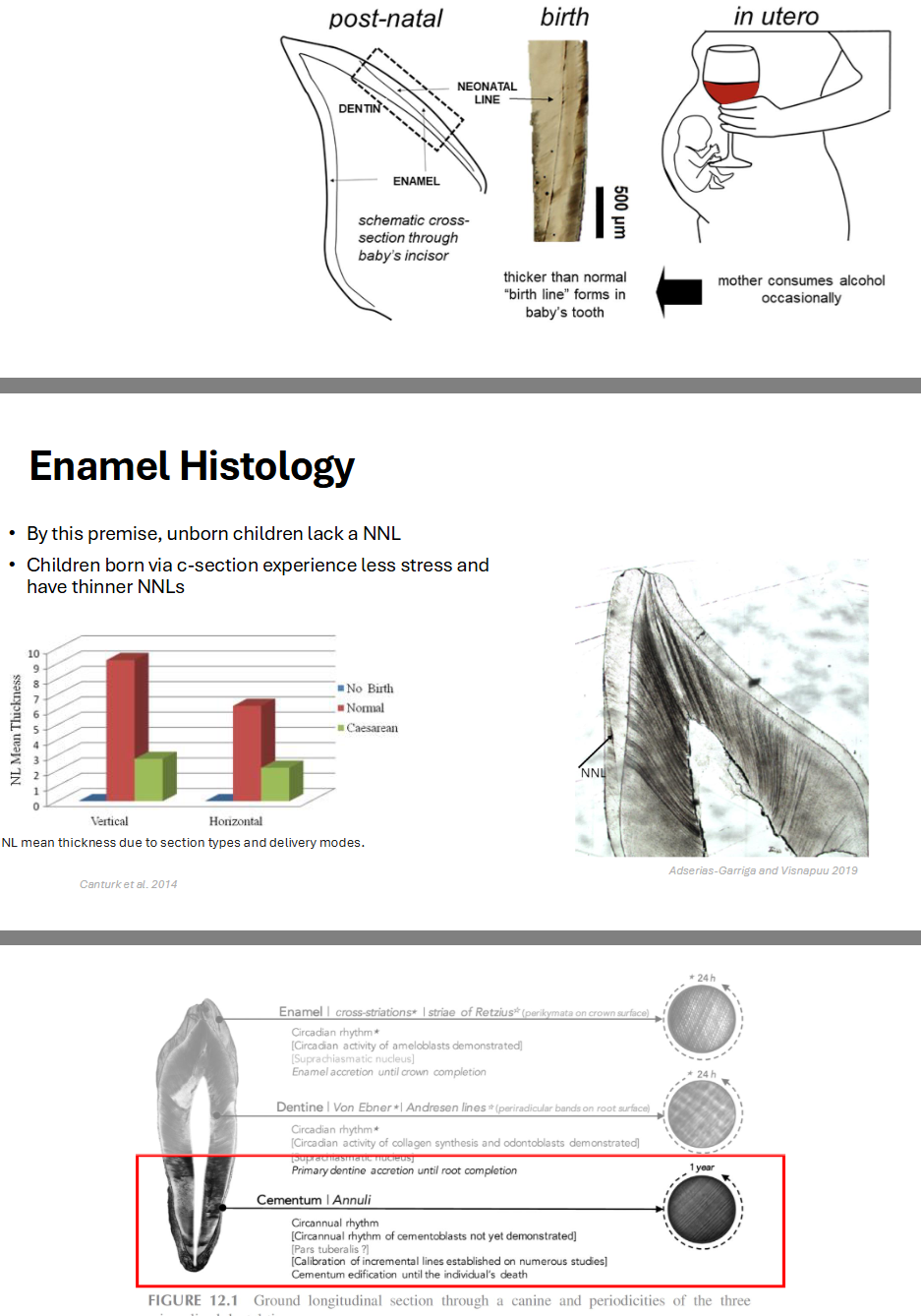 <ul><li><p>Similar periodic growth (and growth arrest) characterizes the histological structure of tooth enamel and dentin</p></li><li><p>Study of incremental development of dental tissues => <strong>periodicity</strong></p></li><li><p>In enamel, Striae of Retzius develop at a periodicity of ~8-9 days in humans; Cross striations: daily</p></li><li><p><strong>What does this mean?: Daily (24 h) record of circadian rythym, stress events recorded</strong></p></li><li><p>Remember, teeth start developing in utero!</p></li><li><p>The neonatal line (NNL) applies the same premise to the birth event--> more stressful the event, the more accentuated the line</p></li><li><p>Also visible in bone</p></li><li><p>By this premise, unborn children lack a NNL</p></li><li><p>Children born via c-section experience less stress and have thinner NNLs</p></li></ul><p></p>