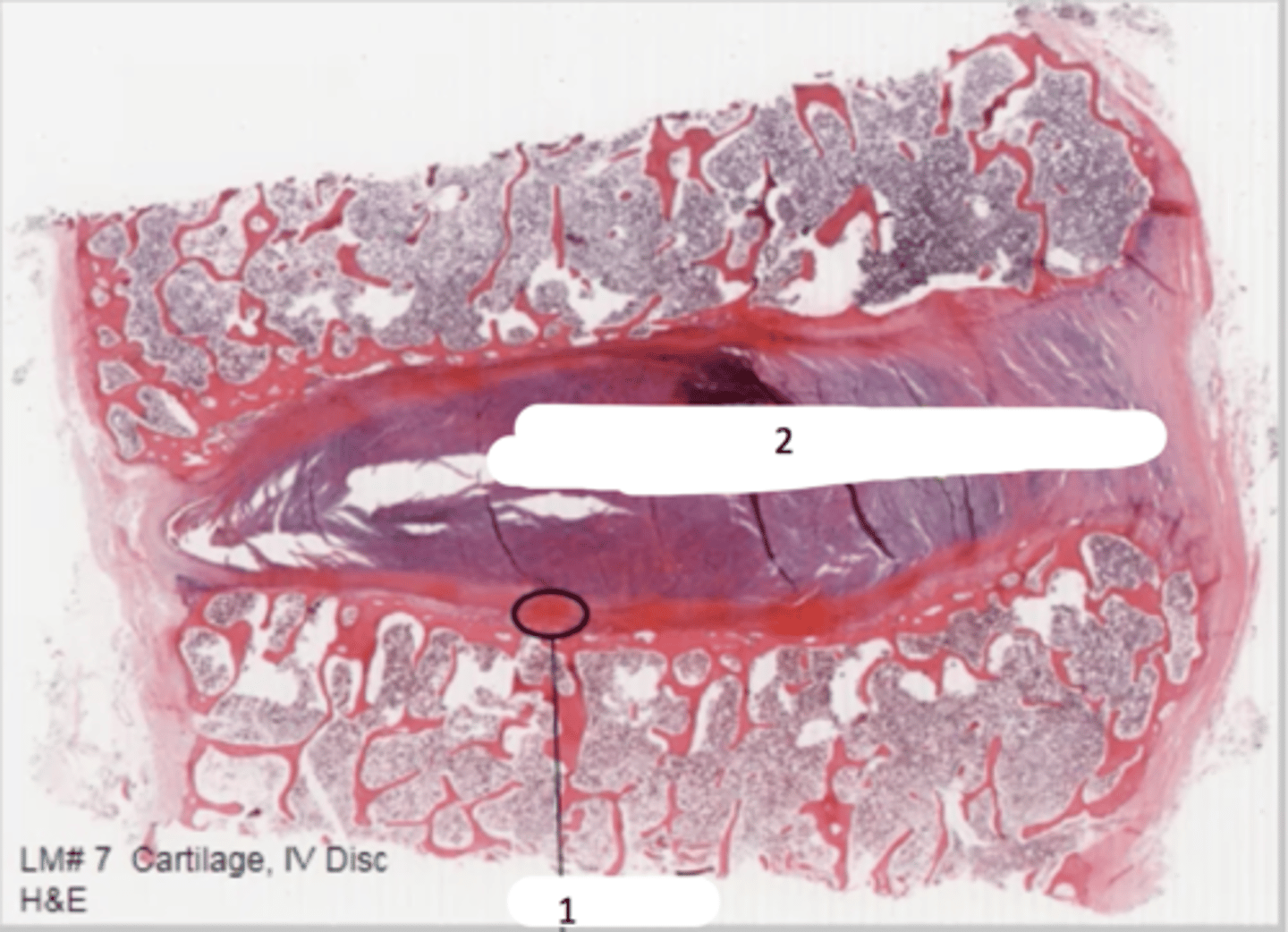 <p>trabecular bone, skeletal muscle. inside, annulus fibrosus (fibrocartilage). nucleus pulposus</p>