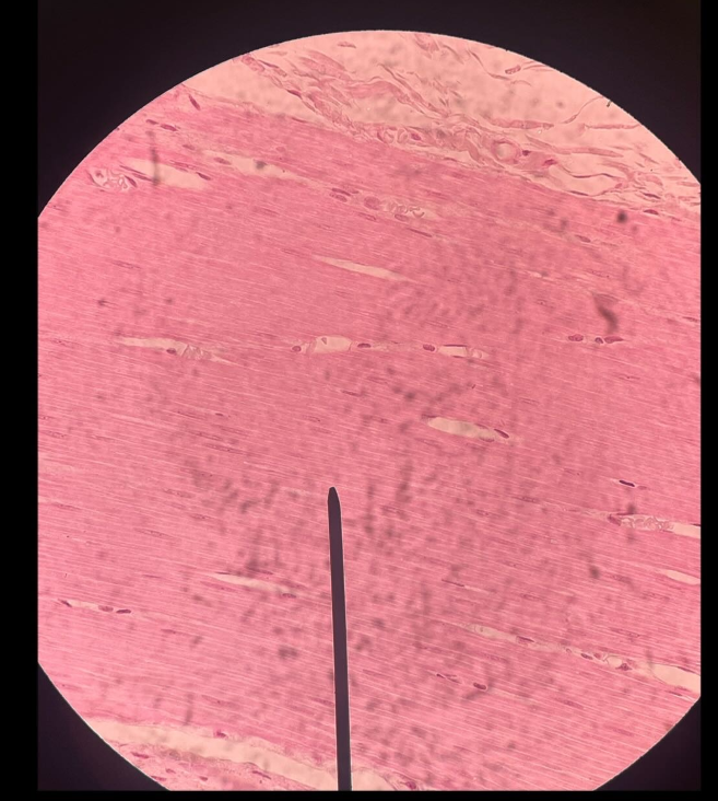 <p>ID tissue</p>