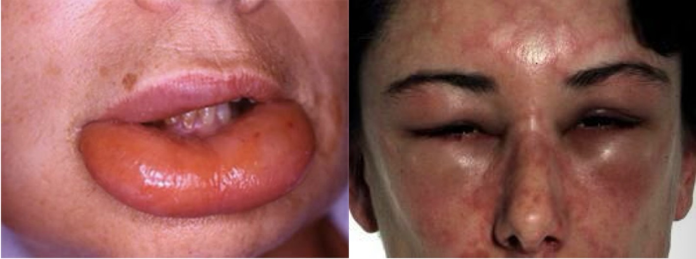 <p>CHẨN ĐOÁN ?</p>