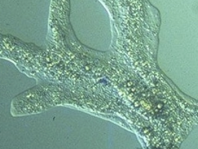 <p>What protist is this?</p>