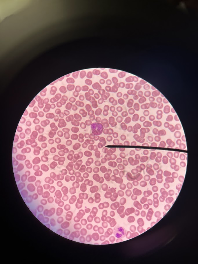 <p>The slide depicts which type of leukocytes</p>