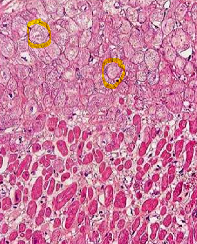 <ul><li><p>kaupiasi vanduo</p></li><li><p>patinsta</p></li><li><p><strong>citoplazma blyški, atsiranda vakuolės</strong></p></li><li><p><strong>branduolys išsaugomas</strong></p></li></ul><p></p>