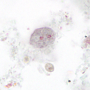 <p>6-15um, Binucleate, no external flagella. Large karyosome, no PC. May have vacuoles with ingested bacteria</p>