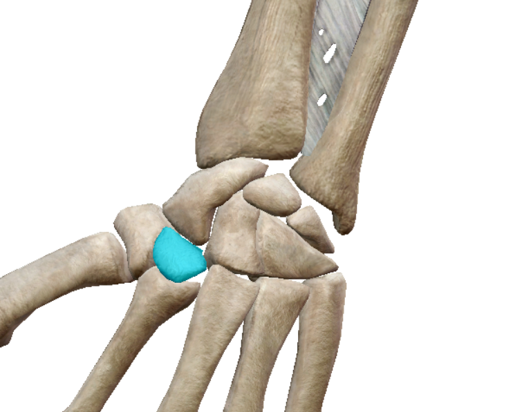 term image