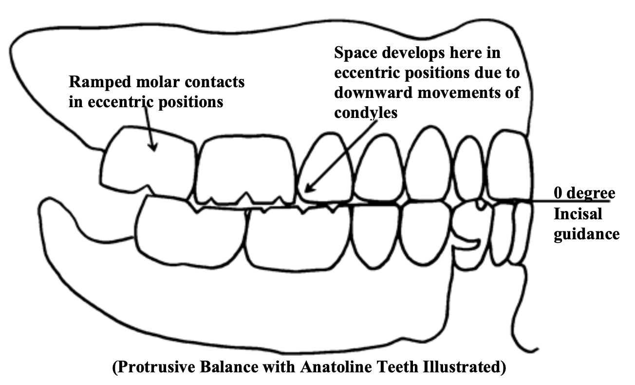 <p>In a CD/RPD case, why should you reduce the incisal guidance whenever possible?</p>