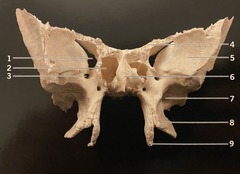 <p>What structure is #5? (Fig. 3.13 Sphenoid Bone, Anterior View)</p>