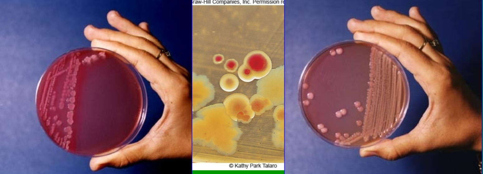 <p>MacConkey Agar positive result</p>