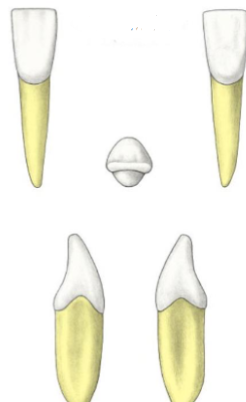 <p>Which tooth?</p>