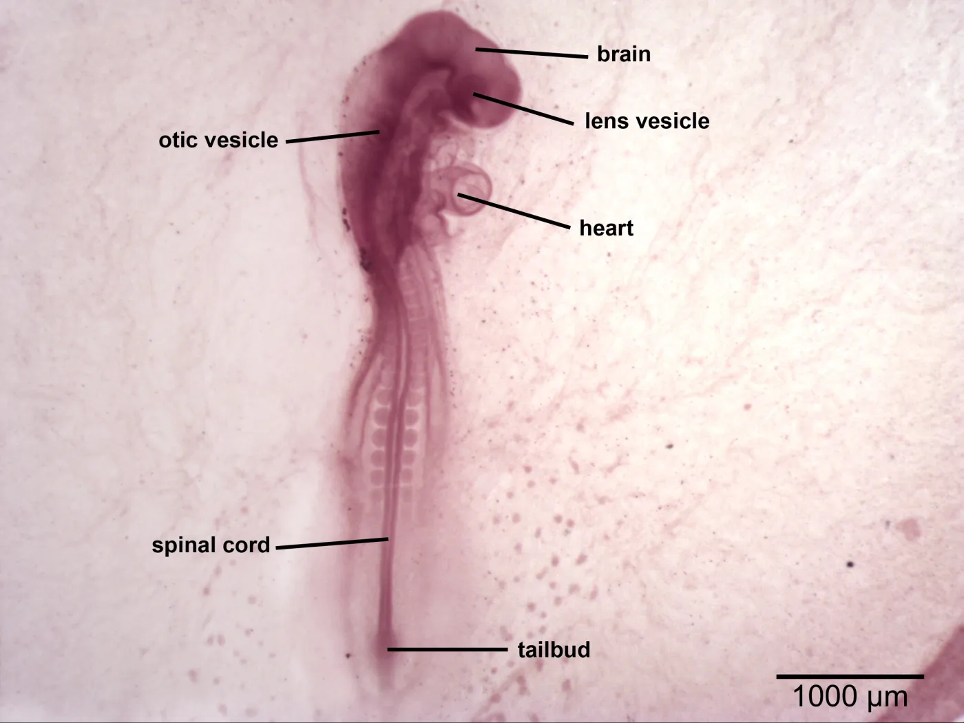 <p>otic vesicles</p>