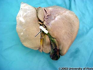 <p>what liver fissure on the VISCERAL surface of the liver is being highlighted?</p>