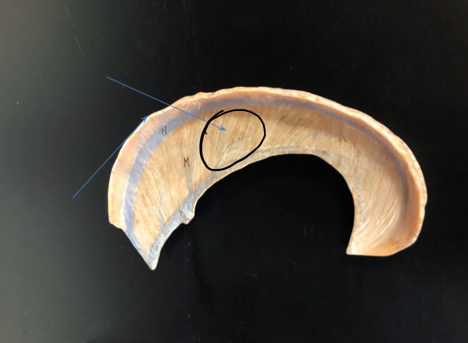 <p>Identify the circled area?</p>