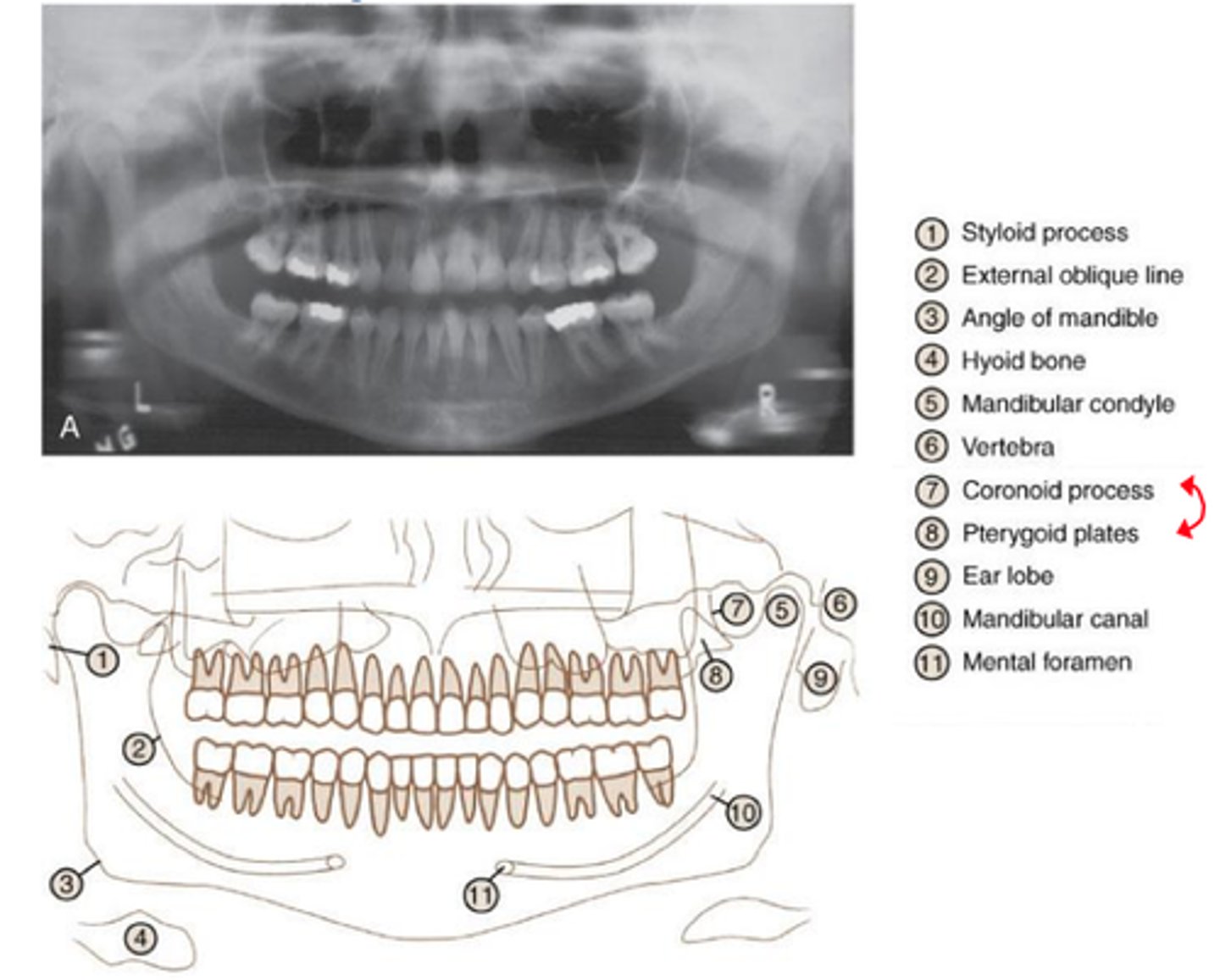 <p>provides full view of the upper & lower jaw</p>