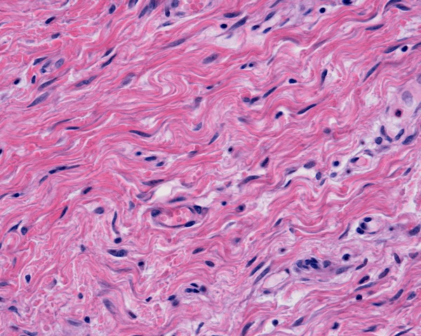 <p>This tissue makes up the adventitia--a type of serosa that lines digestive organs that are OUTSIDE the peritoneal cavity.</p>