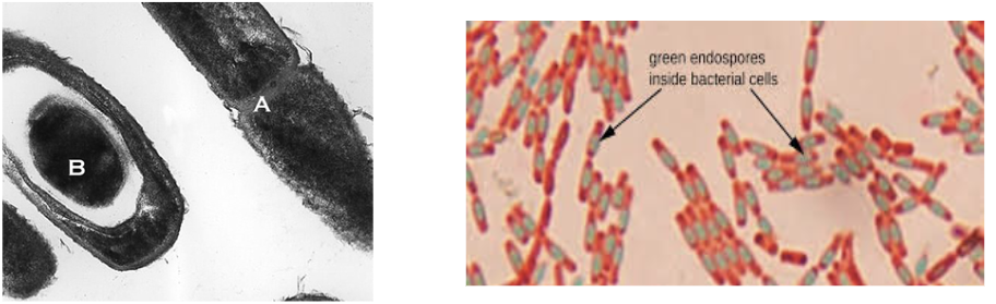 <p>Endospore </p>