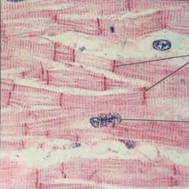 <p>cardiac muscle</p>