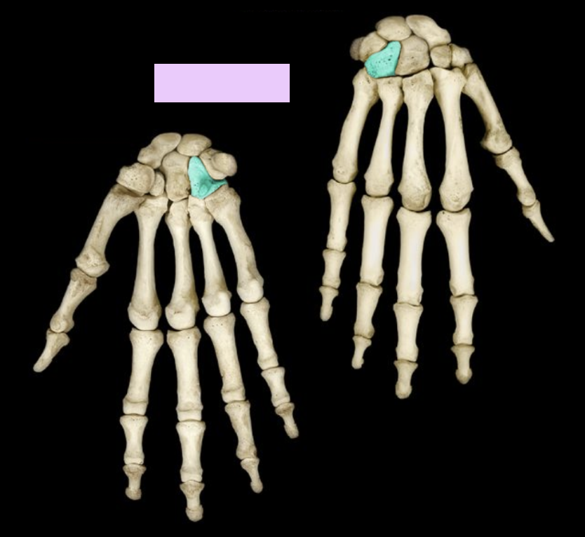 <p>What structure is highlighted?</p>