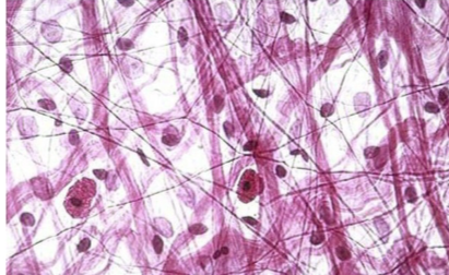 <p>what tissue is this</p>