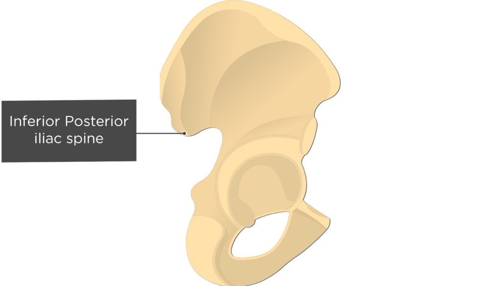 <p>Posterior Inferior Iliac Spine (PIIS)</p>