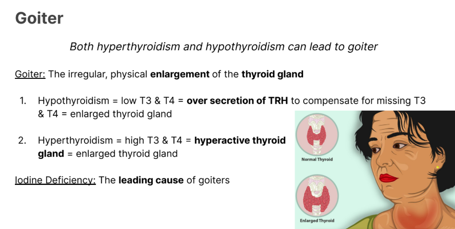 <p>The irregular, physical <strong>enlargement </strong>of the <strong>thyroid gland</strong></p><ol><li><p><strong>Hypothyroidism </strong>= low T3 & T4 = <strong>over secretion of<em> TRH</em></strong> (thyroid releasing hormone) to compensate for missing T3 & T4 = <em>enlarged thyroid gland</em></p></li></ol><p></p>