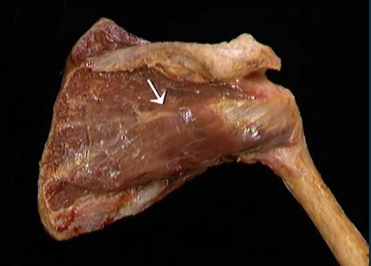 <p>Oppervlakkig, schouder</p>