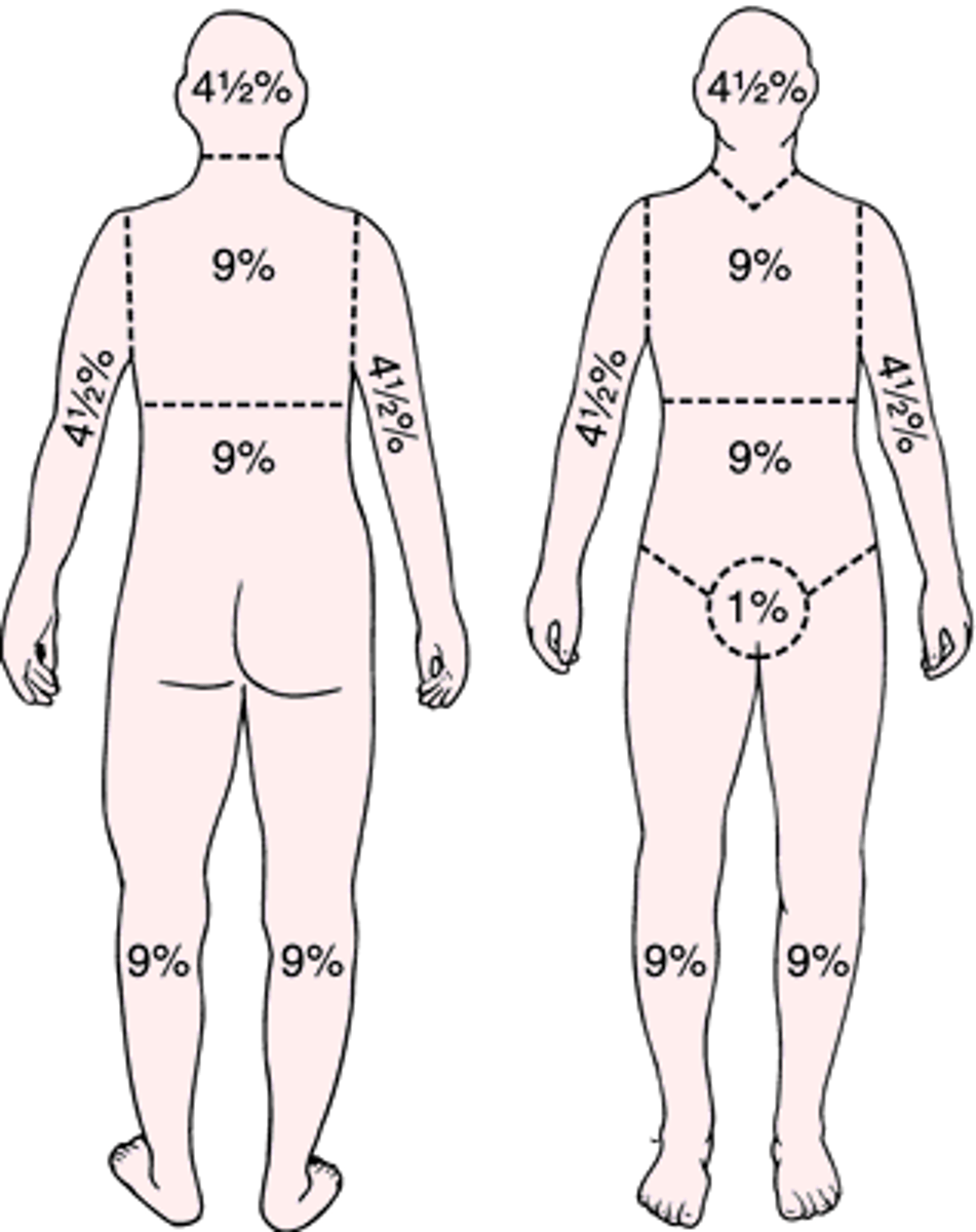 <p>Rule of nines</p><p>foley (more than 30mL/hr)</p><p>IV meds only</p><p>Fluid resuscitation immediately</p>