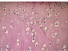 <p>What tissue (cartilage) </p>