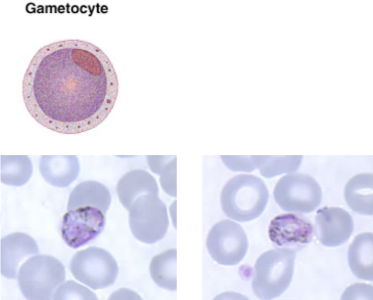 <ul><li><p><span style="background-color: transparent;">The plasmodium malaria gametocyte resembles that of plasmodium vivax, but it’s smaller. </span></p></li><li><p><span style="background-color: transparent;">The brown pigment is darker and coarser than that of Plasmodium vivax.</span></p></li><li><p><span style="background-color: transparent;">Other forms of this stage also tend to assume an oval shape.</span></p></li><li><p><span style="background-color: transparent;">There are no Schuffner’s dots present in this form in plasmodium malaria.</span></p></li></ul><p></p>
