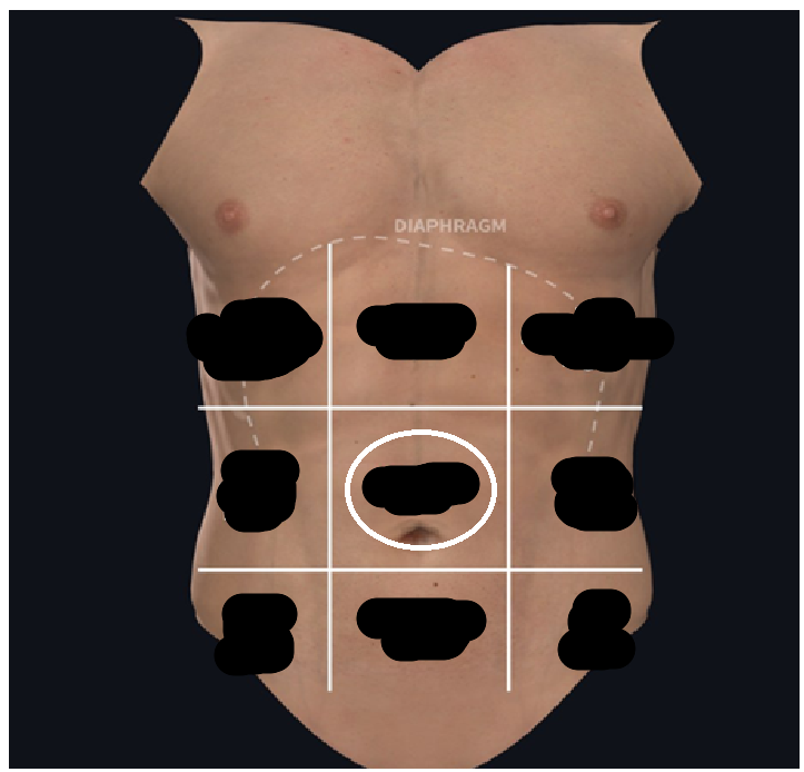 <ul><li><p><span style="background-color: transparent;">Central&nbsp;</span></p></li><li><p><span style="background-color: transparent;">Surrounding navel</span></p></li></ul><p></p>