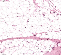 <p>What type of cells are majority on this image?</p>