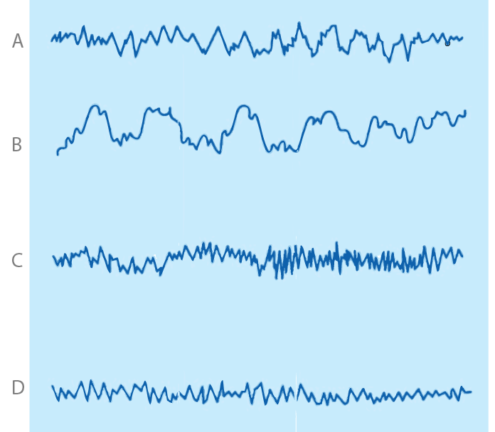<p>Identify the type of brain waves indicated by “C”</p>