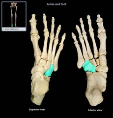 <p>Name this specific bone of the foot.</p>