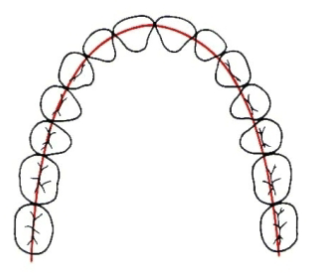 <p>A line the follows the <strong>central grooves</strong> of the posterior teeth and the <strong>incisal edges</strong> of the anterior teeth</p>