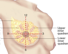 <p>top left line points to this</p>