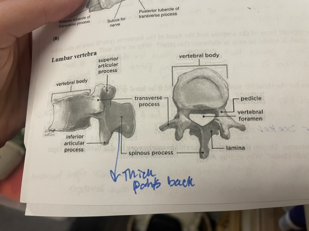 <p>thick spinous process that points back </p>