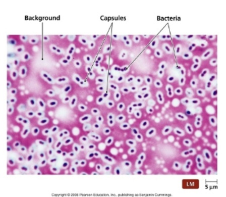 <p>Highlights bacterial capsules as halos surrounding a cell, often using a negative stain background</p>