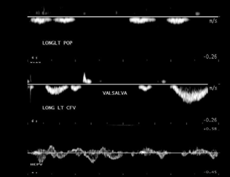 <p>what do these waveforms depict?</p>