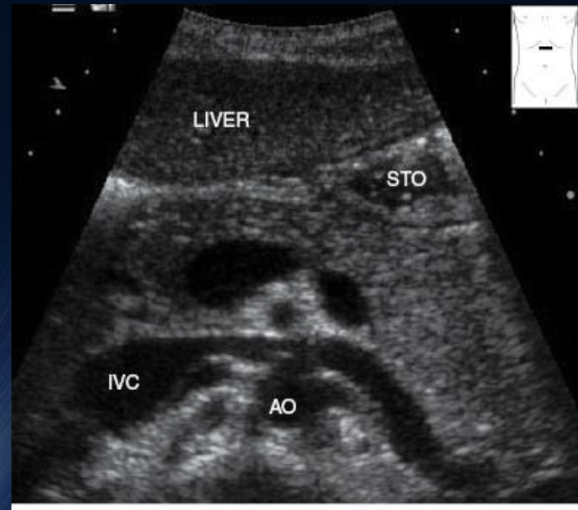 <p>What is this + Label </p>