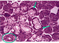 <p>-in salivary gland</p><p>-dark purple spots</p>
