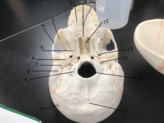 <p>What is 13</p>