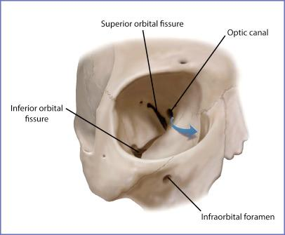 <p><strong>Long slit between</strong> the <strong>greater and lesser sphenoid wings </strong>transmitting <strong>cranial nerves three four and six</strong></p>