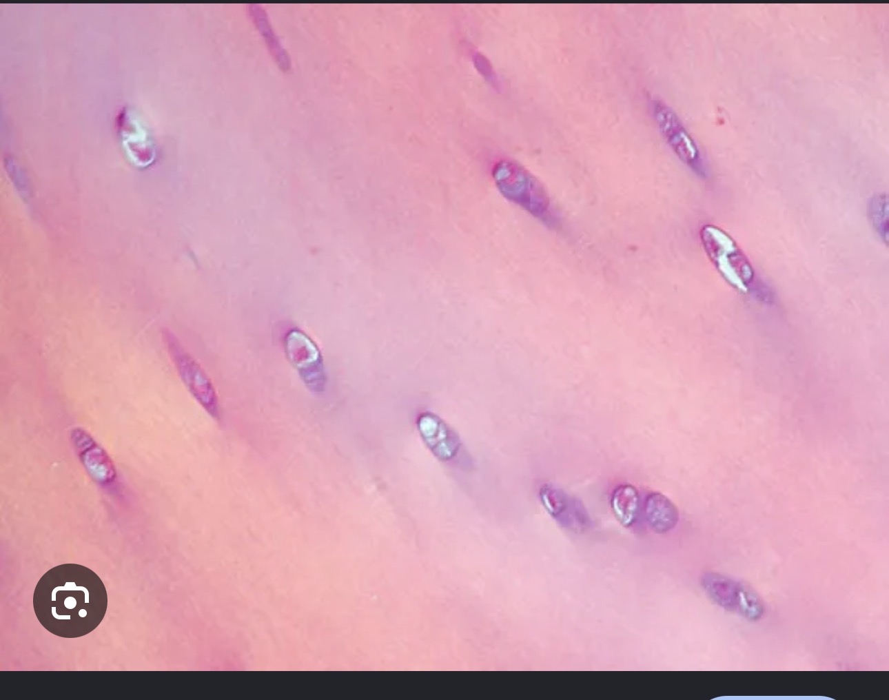 <p>Cartilage name it</p>