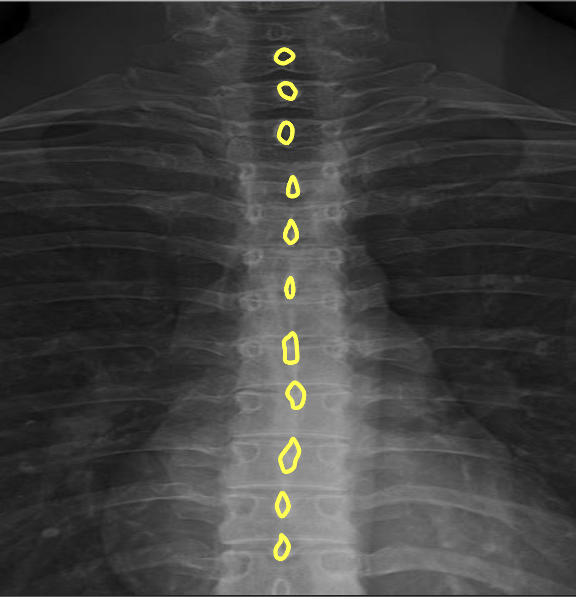 term image